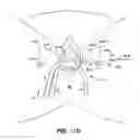 Fig. 27 - IMPLANTS FOR THE TREATMENT OF PELVIC FLOOR DISORDERS