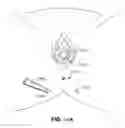 Fig. 30 - IMPLANTS FOR THE TREATMENT OF PELVIC FLOOR DISORDERS