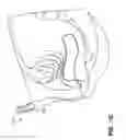 Fig. 32 - IMPLANTS FOR THE TREATMENT OF PELVIC FLOOR DISORDERS