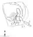 Fig. 34 - IMPLANTS FOR THE TREATMENT OF PELVIC FLOOR DISORDERS