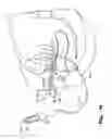 Fig. 37 - IMPLANTS FOR THE TREATMENT OF PELVIC FLOOR DISORDERS