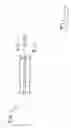 Fig. 43 - IMPLANTS FOR THE TREATMENT OF PELVIC FLOOR DISORDERS