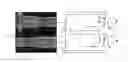 Fig. 01 - Method and visualization module for visualizing bumps of the inner surface of a hollow organ, image processing device and tomographic system