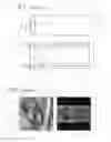 Fig. 02 - Method and visualization module for visualizing bumps of the inner surface of a hollow organ, image processing device and tomographic system