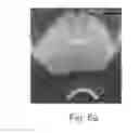 Fig. 09 - Cryotherapy Planning and Control System