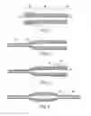 Fig. 04 - Balloon catheters and methods for manufacturing balloons for balloon catheters