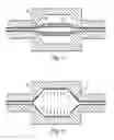 Fig. 05 - Balloon catheters and methods for manufacturing balloons for balloon catheters
