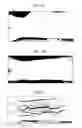 Fig. 06 - Delivery device, system, and method for delivering substances into blood vessels