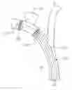Fig. 01 - Removable Core Implant Delivery Catheter