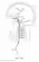Fig. 03 - Removable Core Implant Delivery Catheter