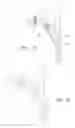 Fig. 05 - Removable Core Implant Delivery Catheter