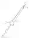 Fig. 01 - Method for positioning an access sheath and a security guide, a catheter for positioning an access sheath and a catheter-access sheath assembly