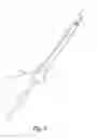 Fig. 05 - Method for positioning an access sheath and a security guide, a catheter for positioning an access sheath and a catheter-access sheath assembly