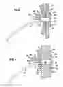 Fig. 04 - GASTROJEJUNAL FEEDING ASSEMBLY