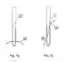 Fig. 02 - Retention element for telescopic device