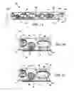 Fig. 02 - Bone plate with complex, adjacent holes joined by a bend relief zone