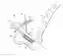 Fig. 01 - AMZ tibial tuberosity transfer system