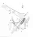 Fig. 02 - AMZ tibial tuberosity transfer system