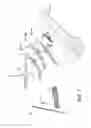Fig. 04 - AMZ tibial tuberosity transfer system
