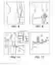 Fig. 05 - AMZ tibial tuberosity transfer system