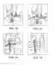 Fig. 06 - AMZ tibial tuberosity transfer system