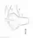 Fig. 08 - AMZ tibial tuberosity transfer system