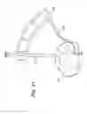 Fig. 09 - AMZ tibial tuberosity transfer system