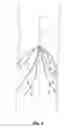 Fig. 04 - Embolus blood clot filter delivery system