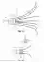 Fig. 08 - Embolus blood clot filter delivery system
