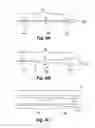 Fig. 10 - Embolus blood clot filter delivery system