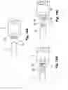 Fig. 16 - Embolus blood clot filter delivery system