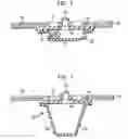 Fig. 04 - Device and method for compressing wounds