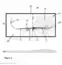 Fig. 11 - Surgical sutures incorporated with stem cells or other bioactive materials