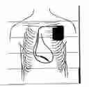 Fig. 01 - METHOD AND APPARATUS FOR DETECTION AND TREATMENT OF AUTONOMIC SYSTEM IMBALANCE