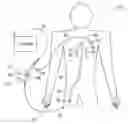 Fig. 01 - EXTERNAL PACEMAKER WITH AUTOMATIC CARDIOPROTECTIVE PACING PROTOCOL
