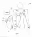 Fig. 02 - EXTERNAL PACEMAKER WITH AUTOMATIC CARDIOPROTECTIVE PACING PROTOCOL