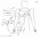 Fig. 01 - Pacing catheter with stent electrode