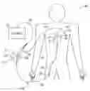 Fig. 01 - Pacing catheter for access to multiple vessels