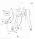Fig. 02 - Pacing catheter for access to multiple vessels