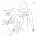 Fig. 01 - Pacemaker integrated with vascular intervention catheter