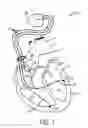 Fig. 02 - System and method of detecting and diagnosing pacing system malfunctions