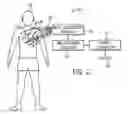 Fig. 03 - System and method of detecting and diagnosing pacing system malfunctions