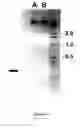 Fig. 12 - Compositions and methods for modifying gene expression using the promoter of ubiquitin conjugating protein coding gene of cotton plants