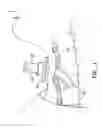Fig. 04 - Tracheostomy Tube