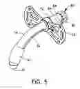 Fig. 06 - Tracheostomy Tube
