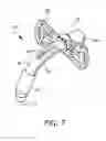 Fig. 08 - Tracheostomy Tube