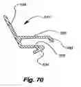 Fig. 49 - Retractable shade with collapsible vanes