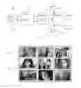 Fig. 04 - Method and apparatus for providing low resolution images in a broadcast system