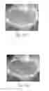 Fig. 02 - Image registration method for medical image sequences