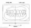 Fig. 01 - Dental image processing device